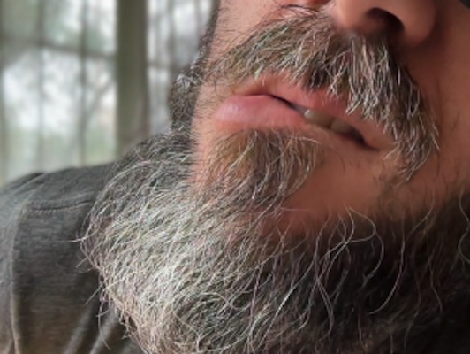 Martincitoxl profile