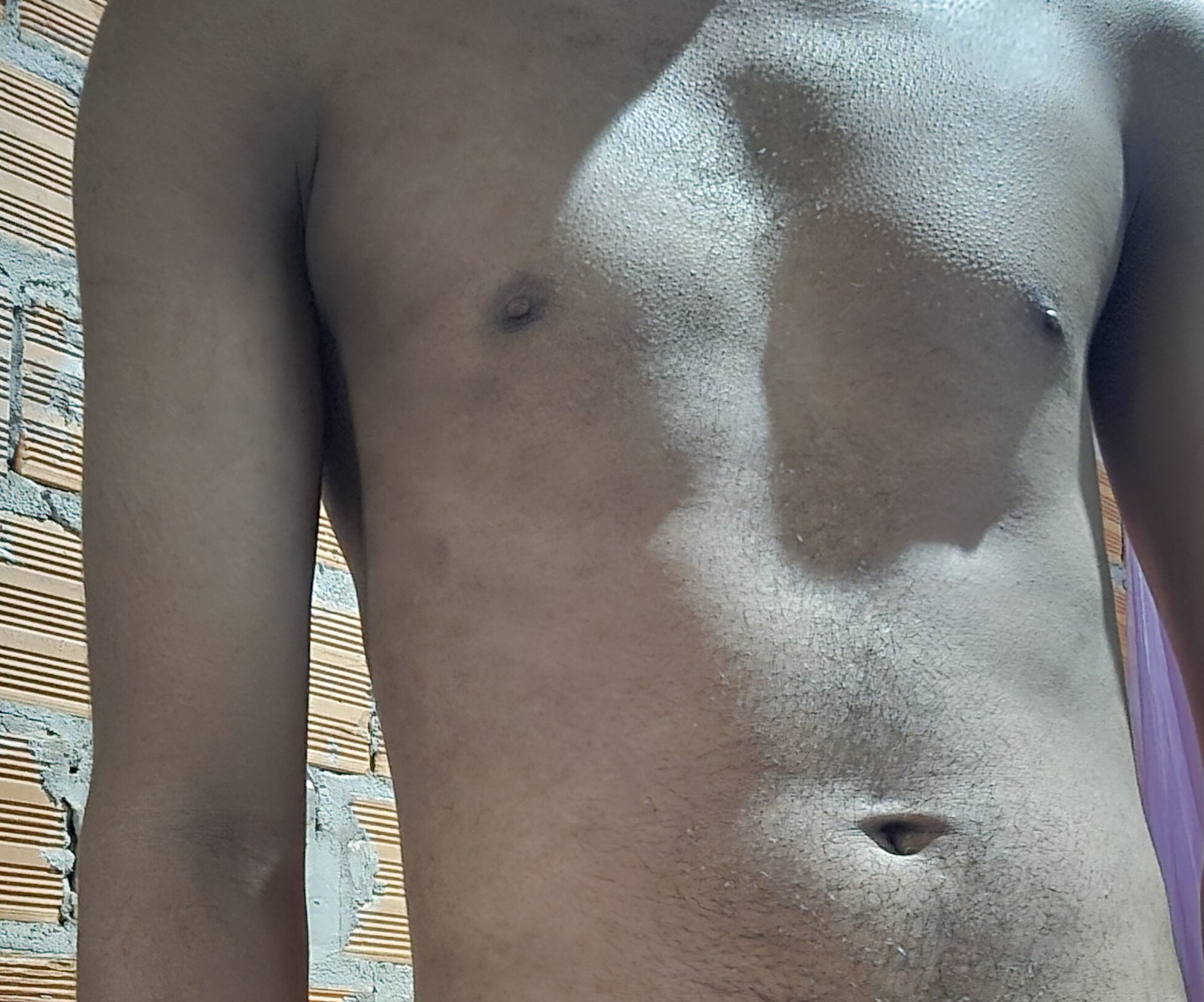 spidertop