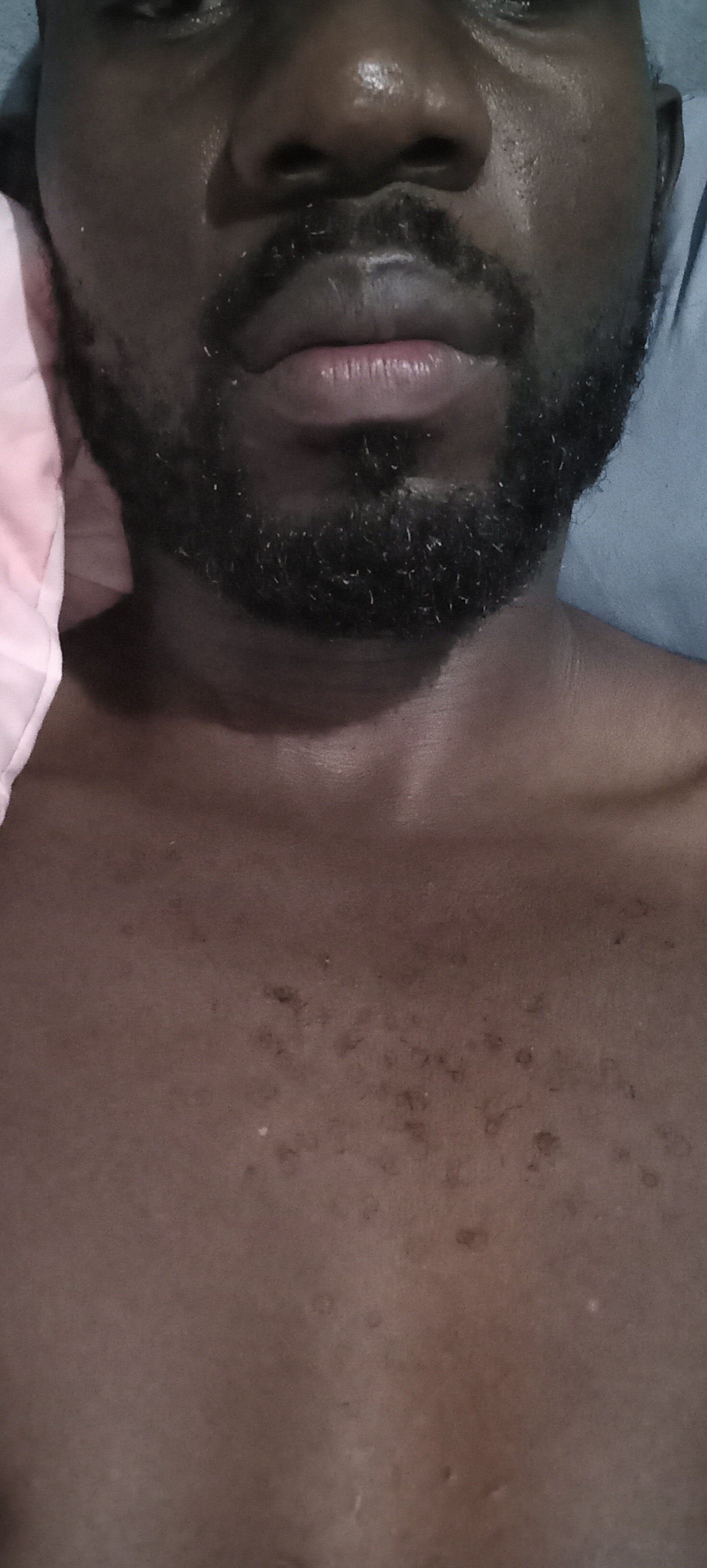 BDGGRSA014