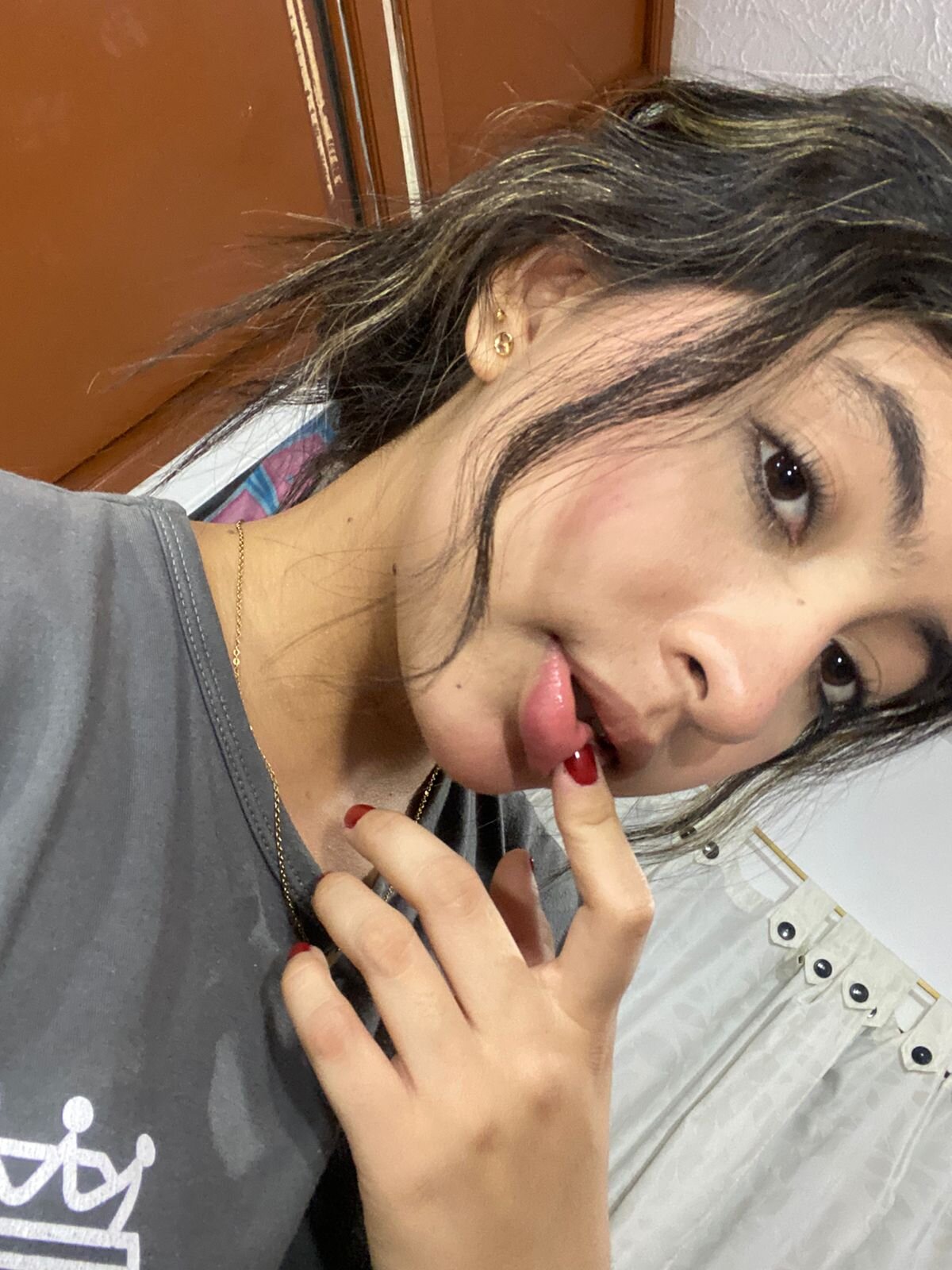 rachel_mds