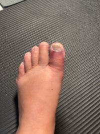 Model HaramaseSeitai