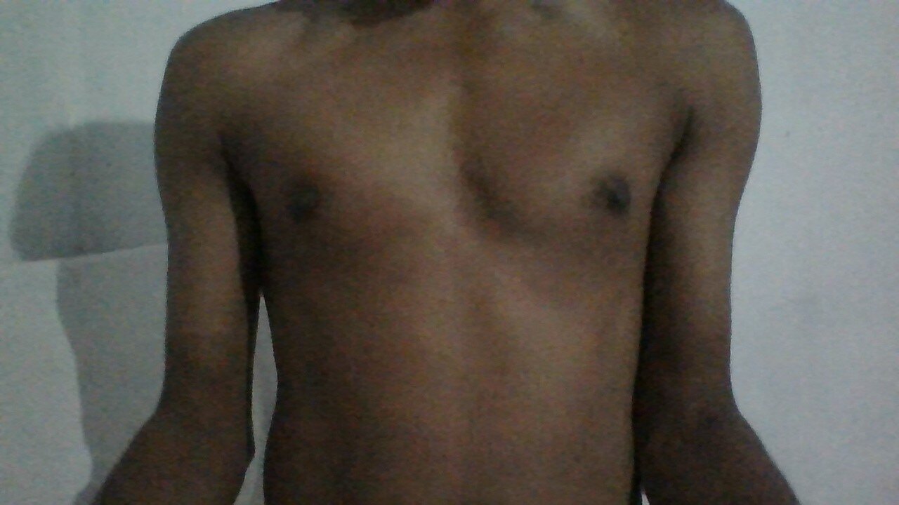 SL_SONIC_