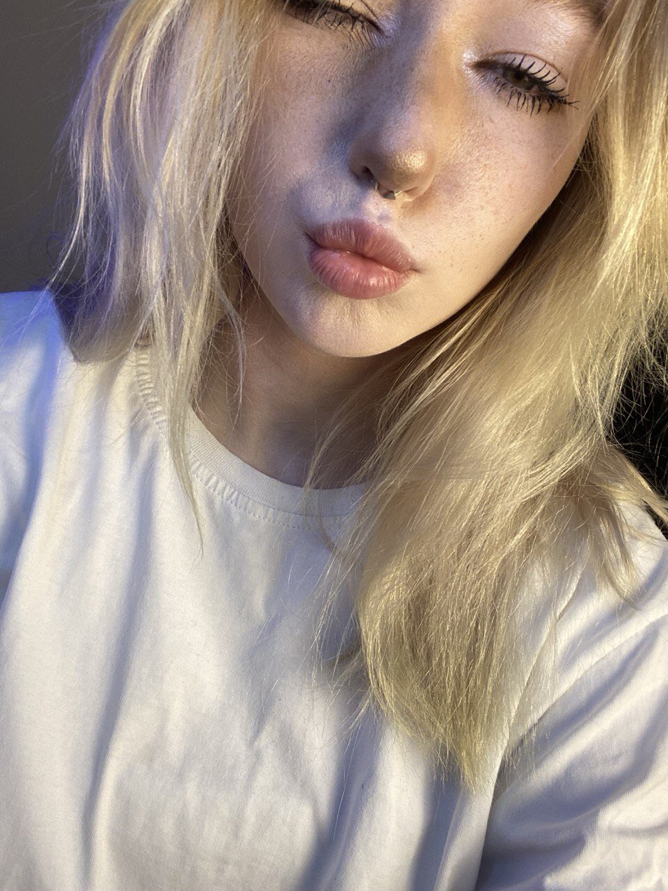 Ane_mia
