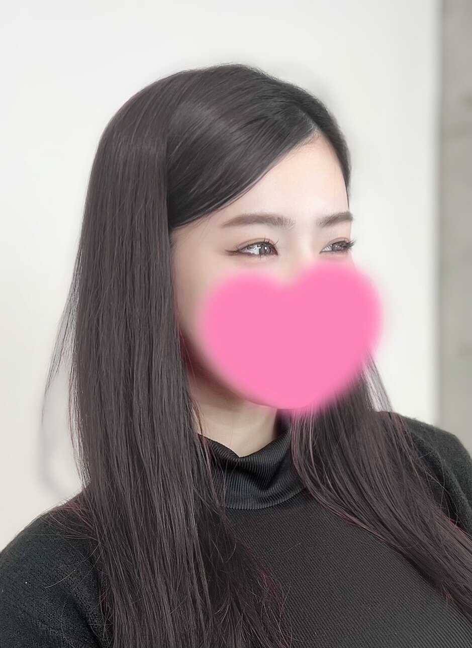 YUME_7_7