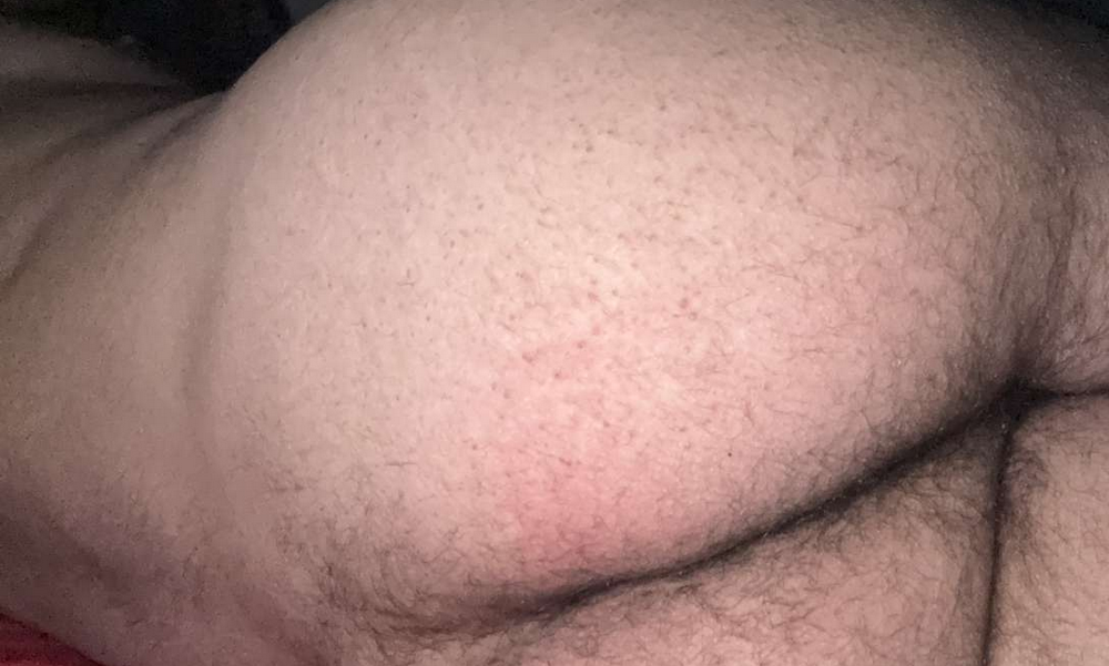 nonochd