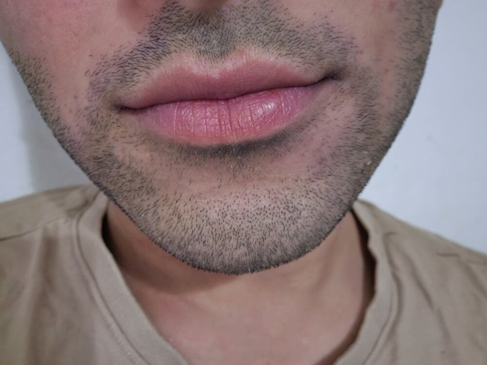Straight-up profile