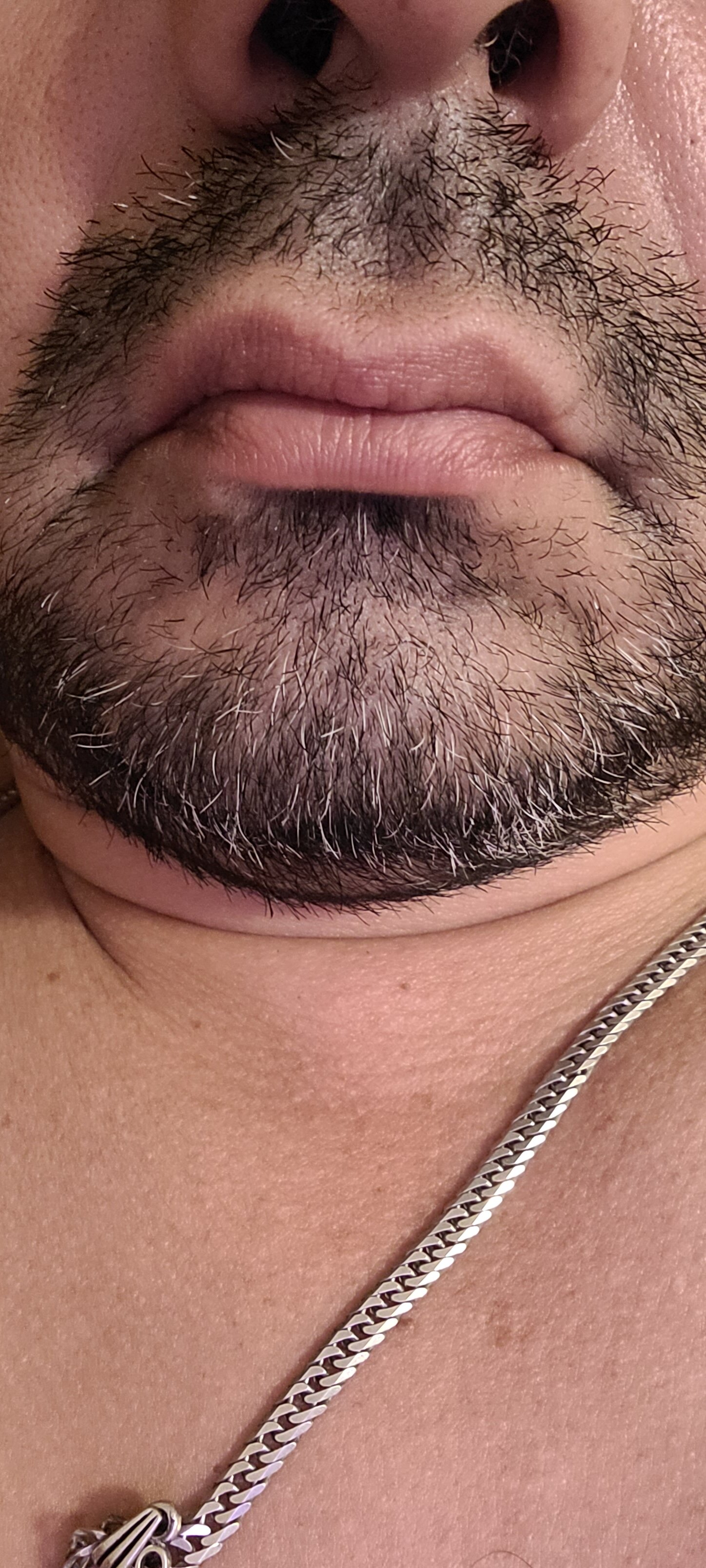 pmtp