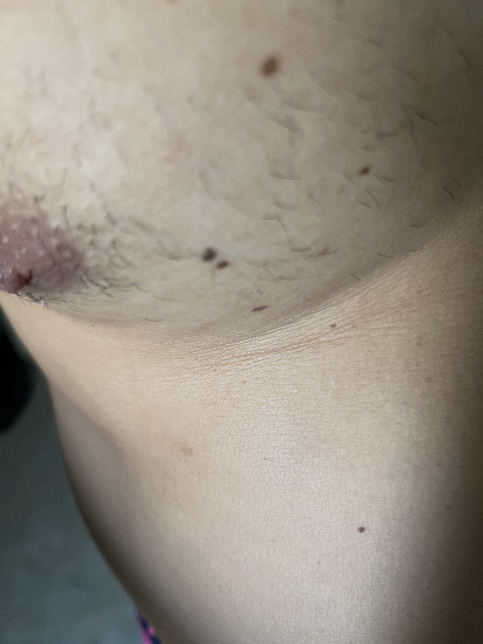 pegapica