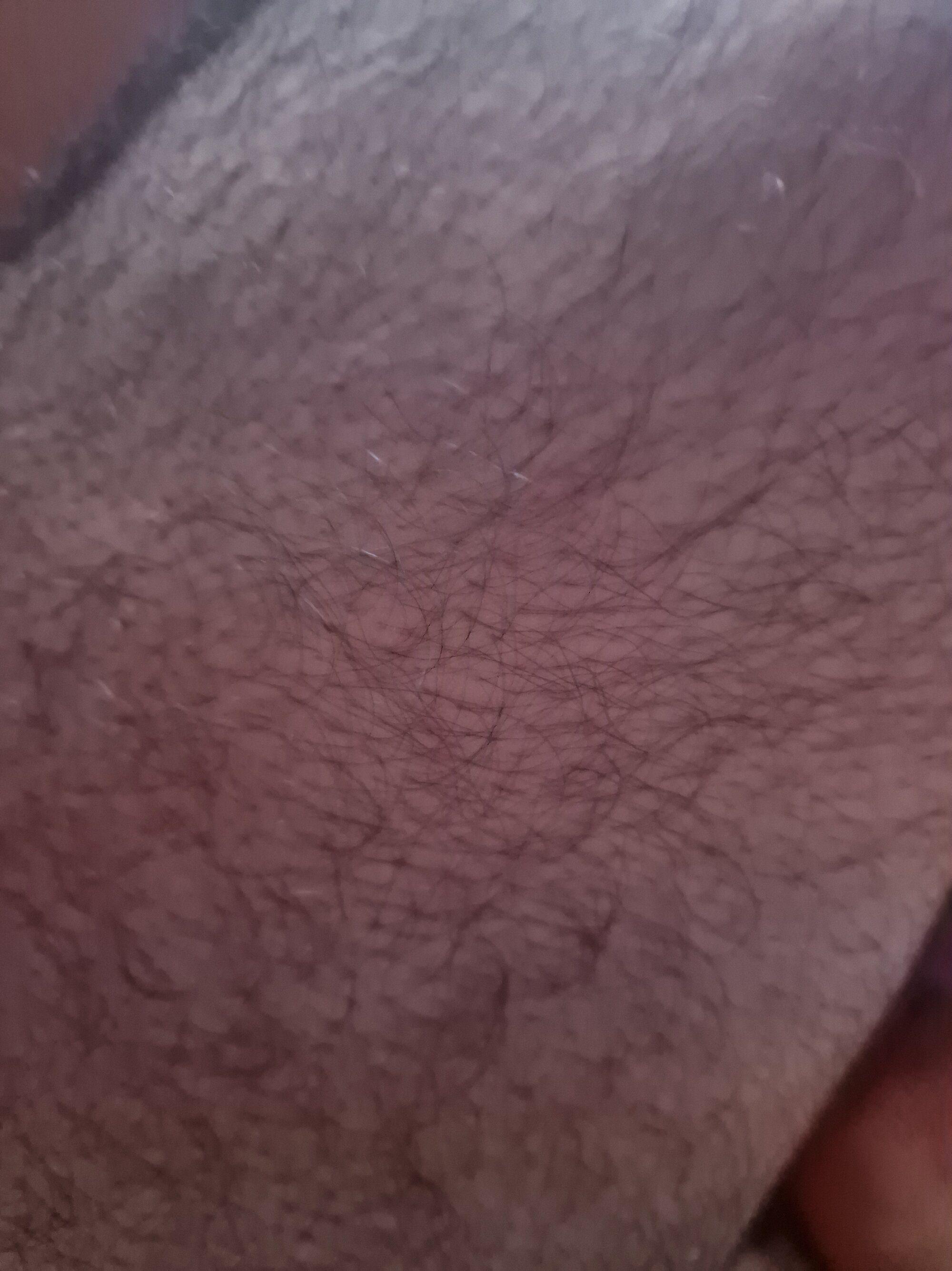 Bigbeardick