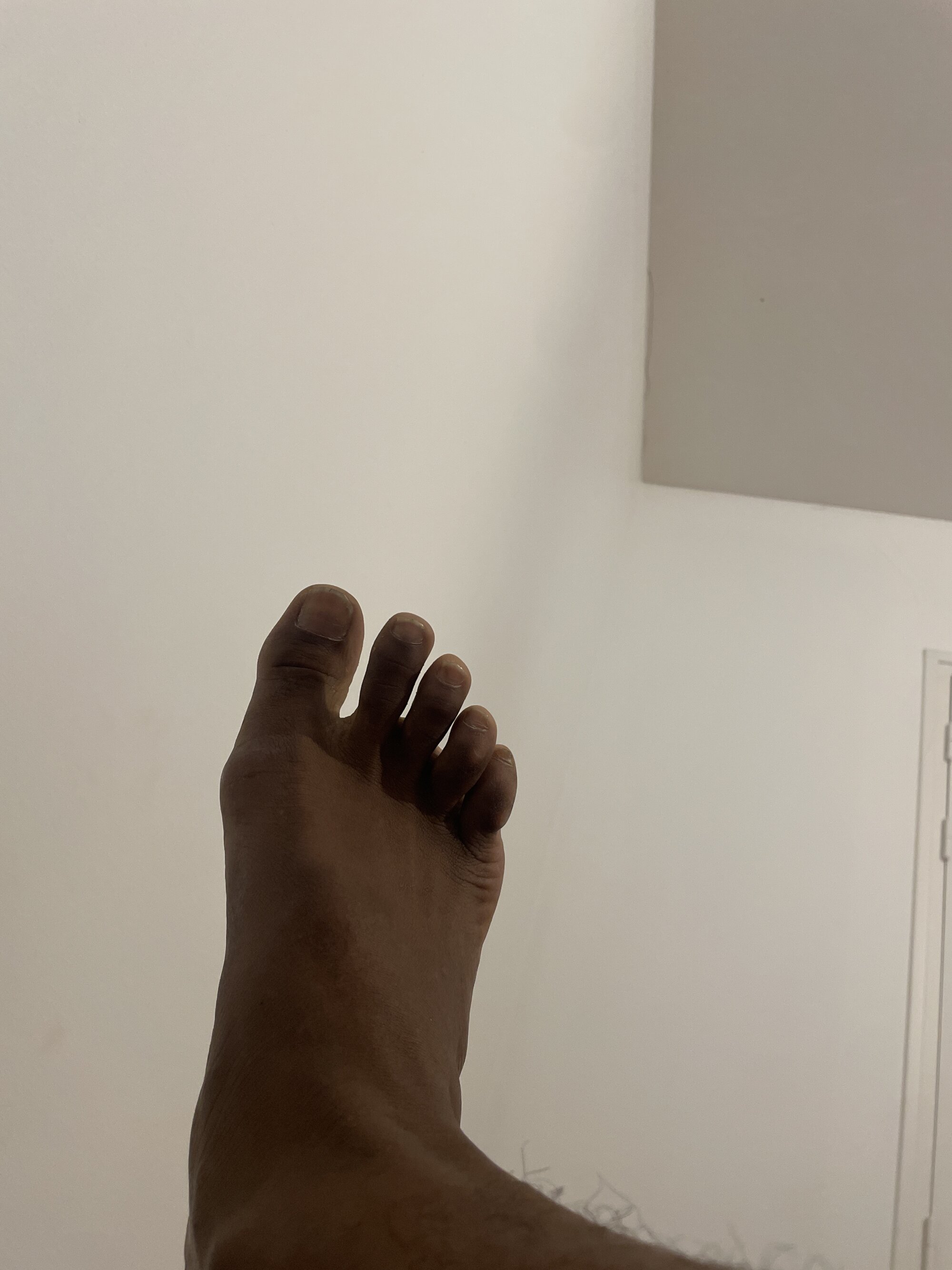 blackbite99