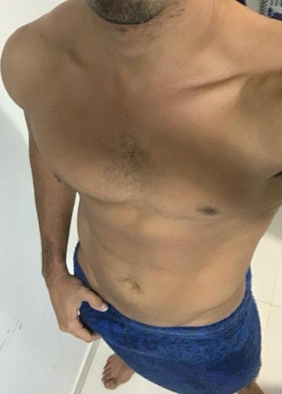 Nerdhot20cm