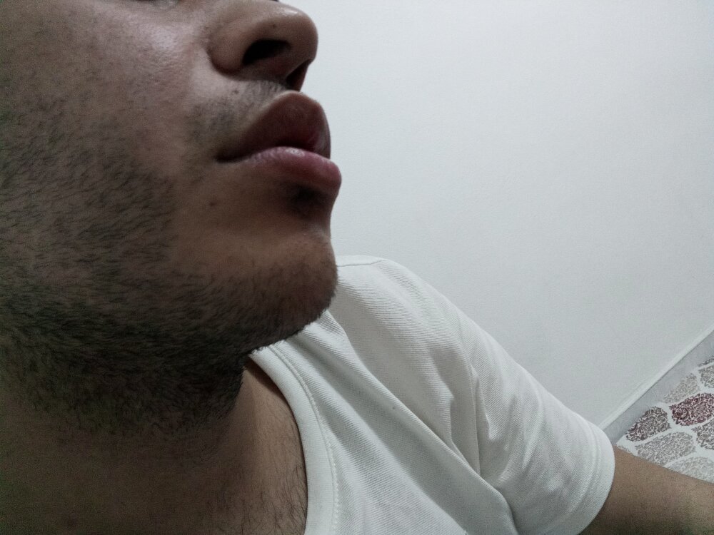 brkl2 profile