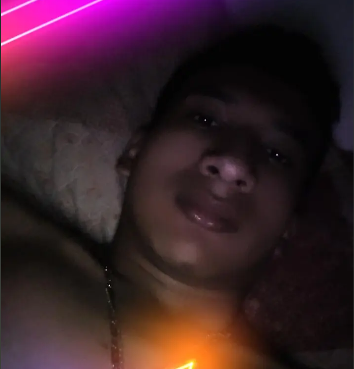 femorale