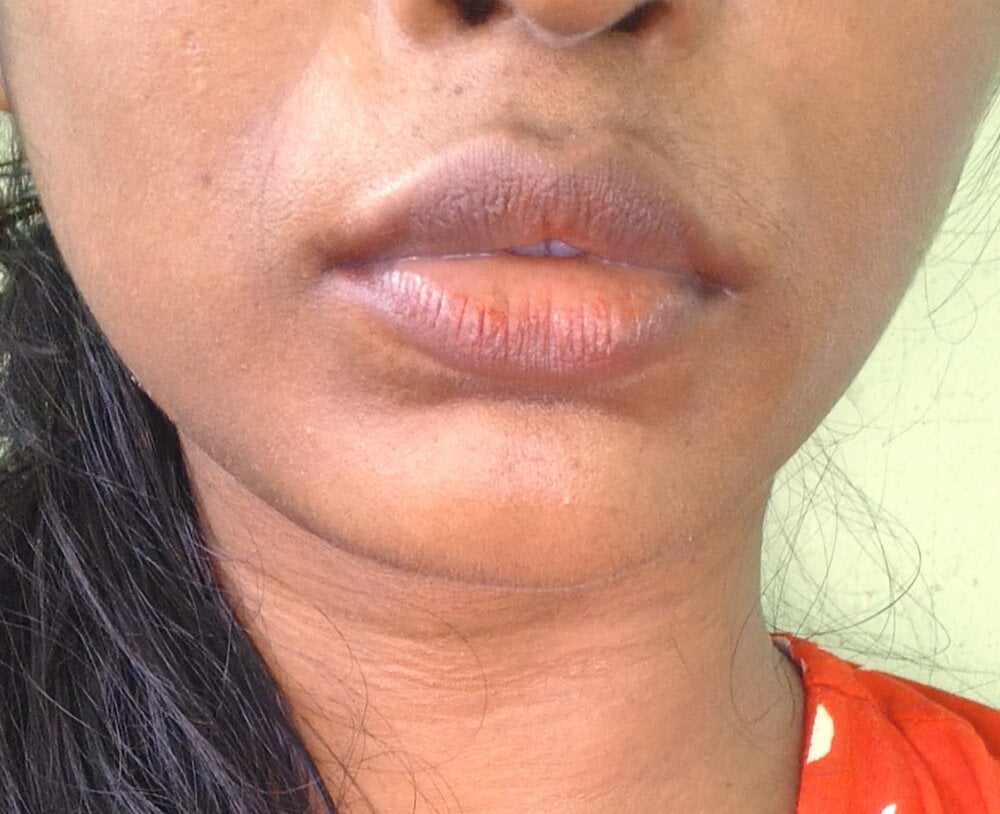 renuka-144 profile