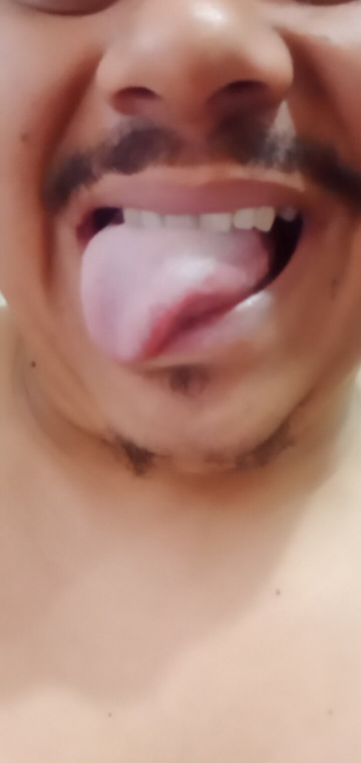 garretohot
