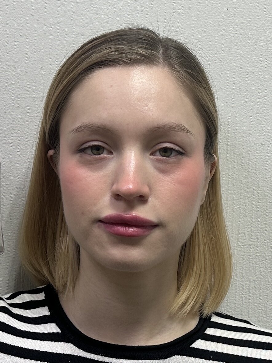HollisGloss
