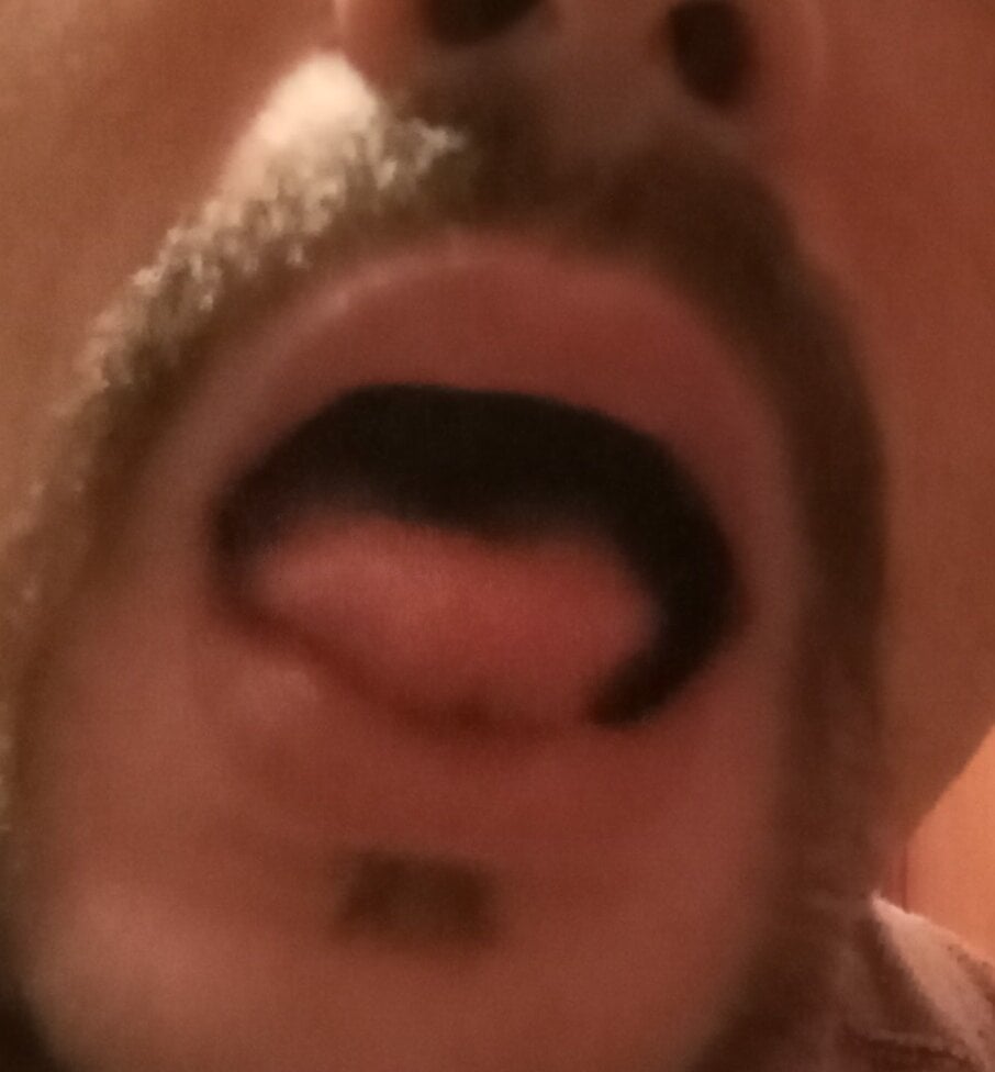 Monstrofat