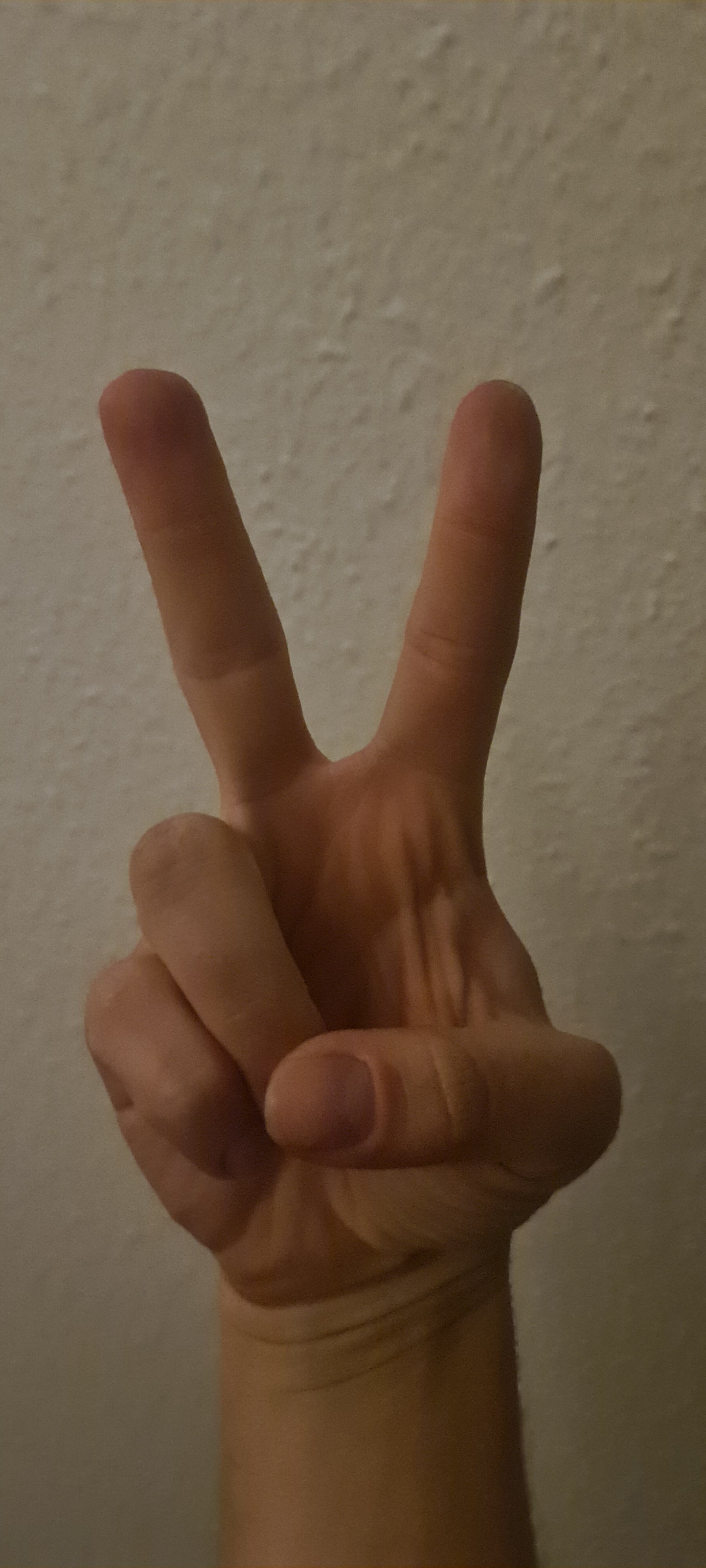 Normaly25