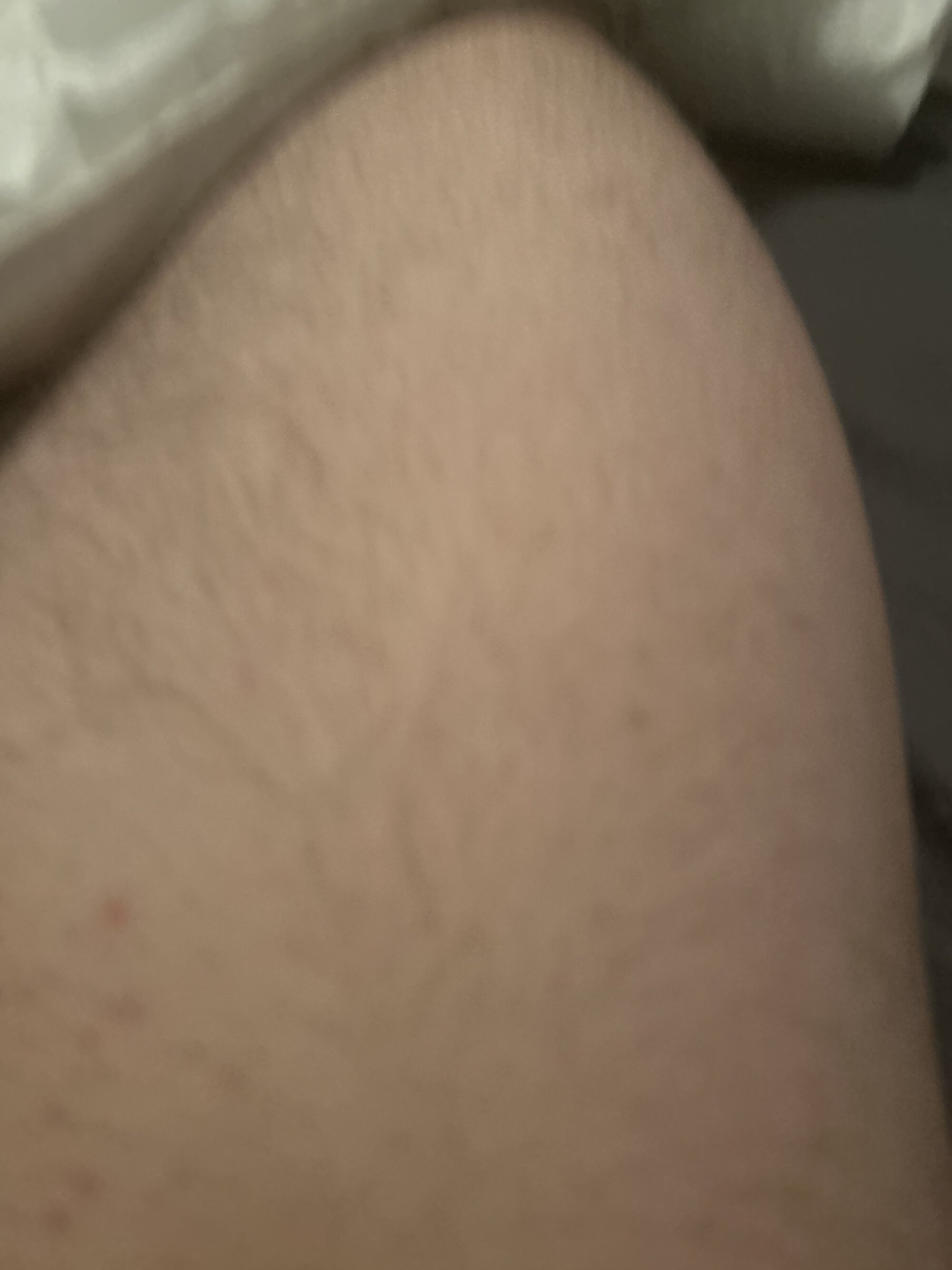 kylilll550933