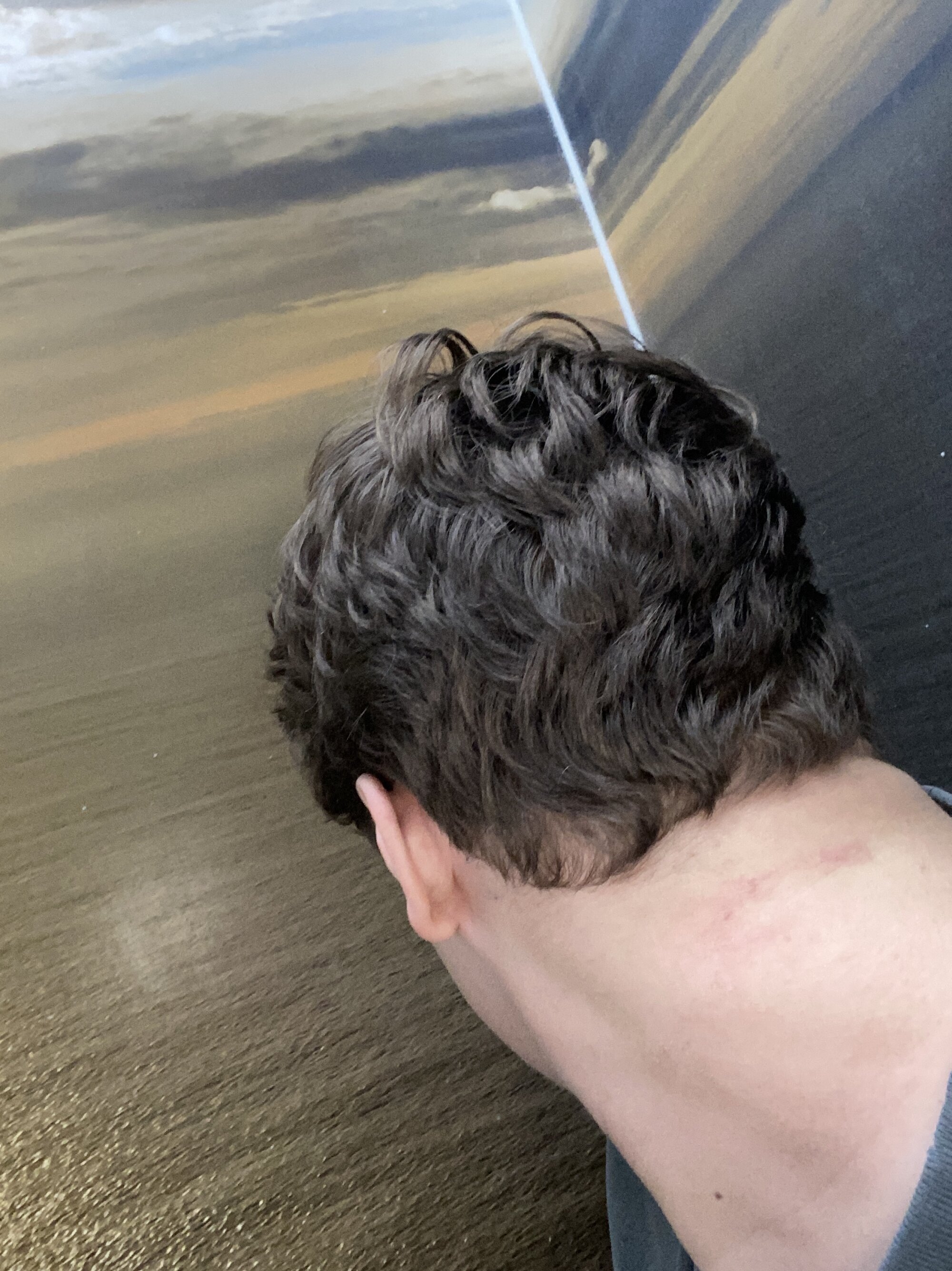 losseass69@xh