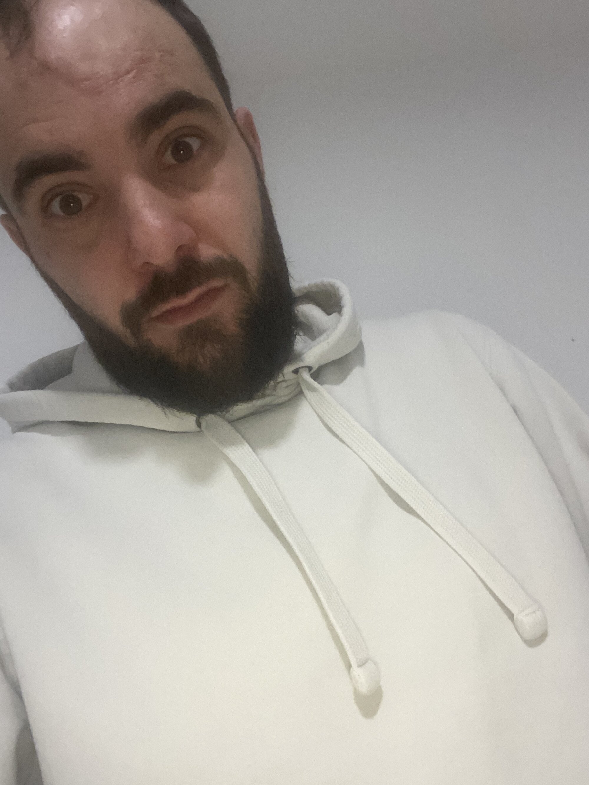 inconnu25000