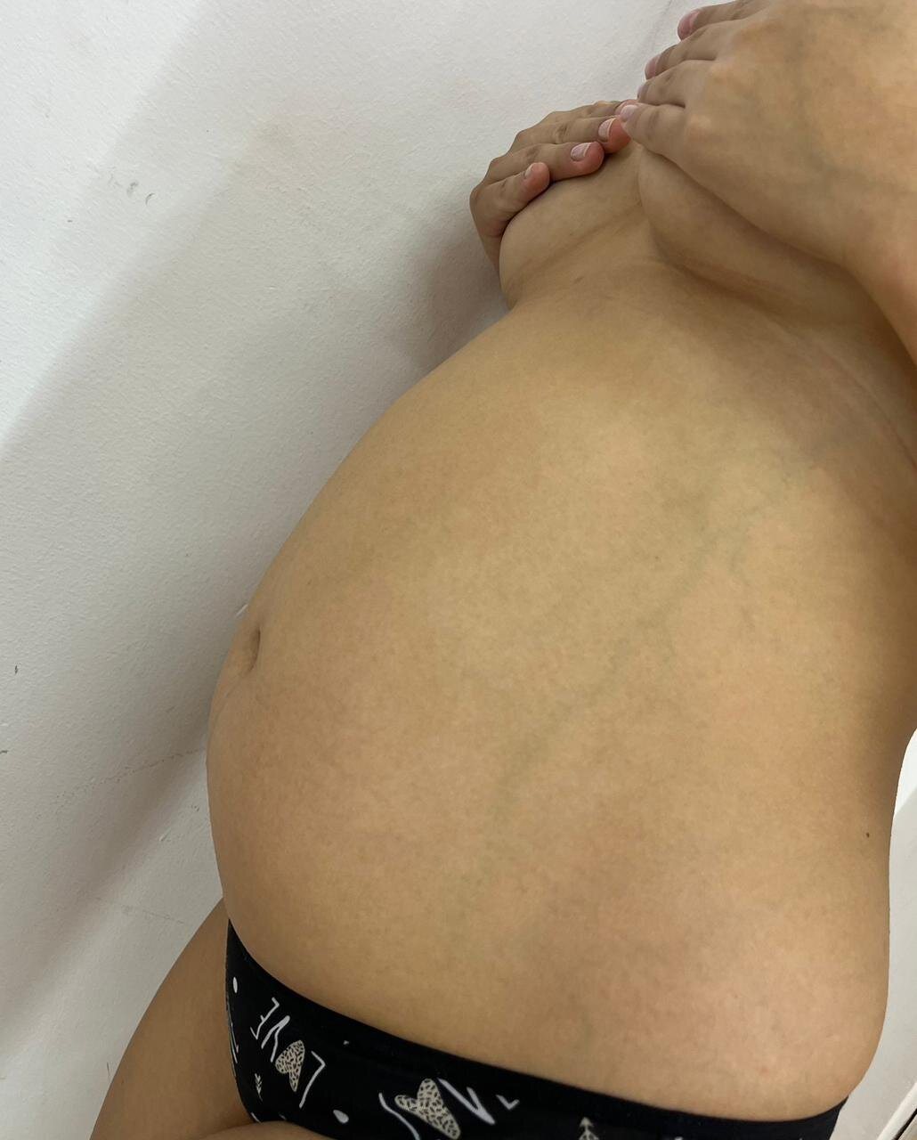 flor_Pregnant69