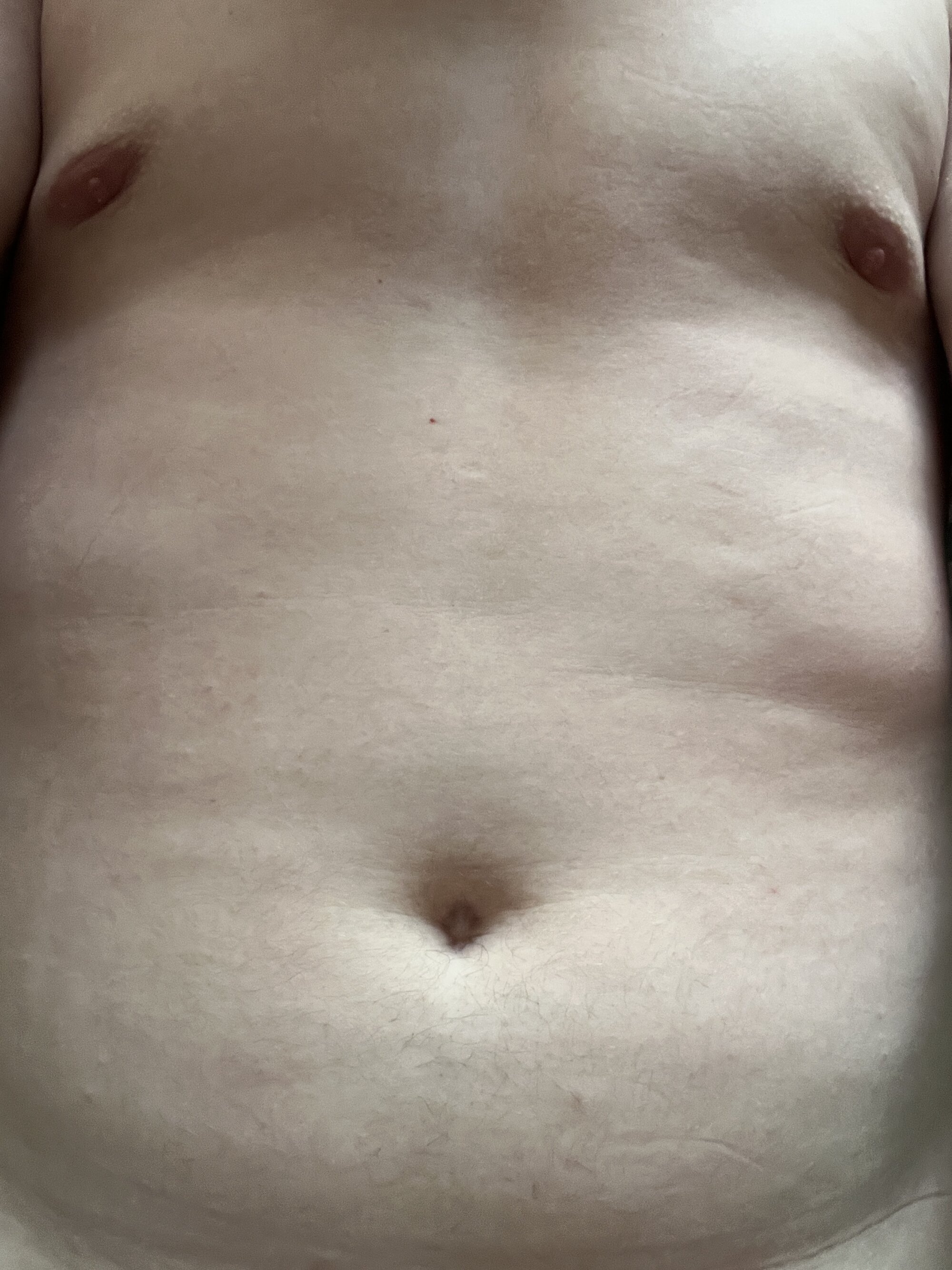 Mann12x4