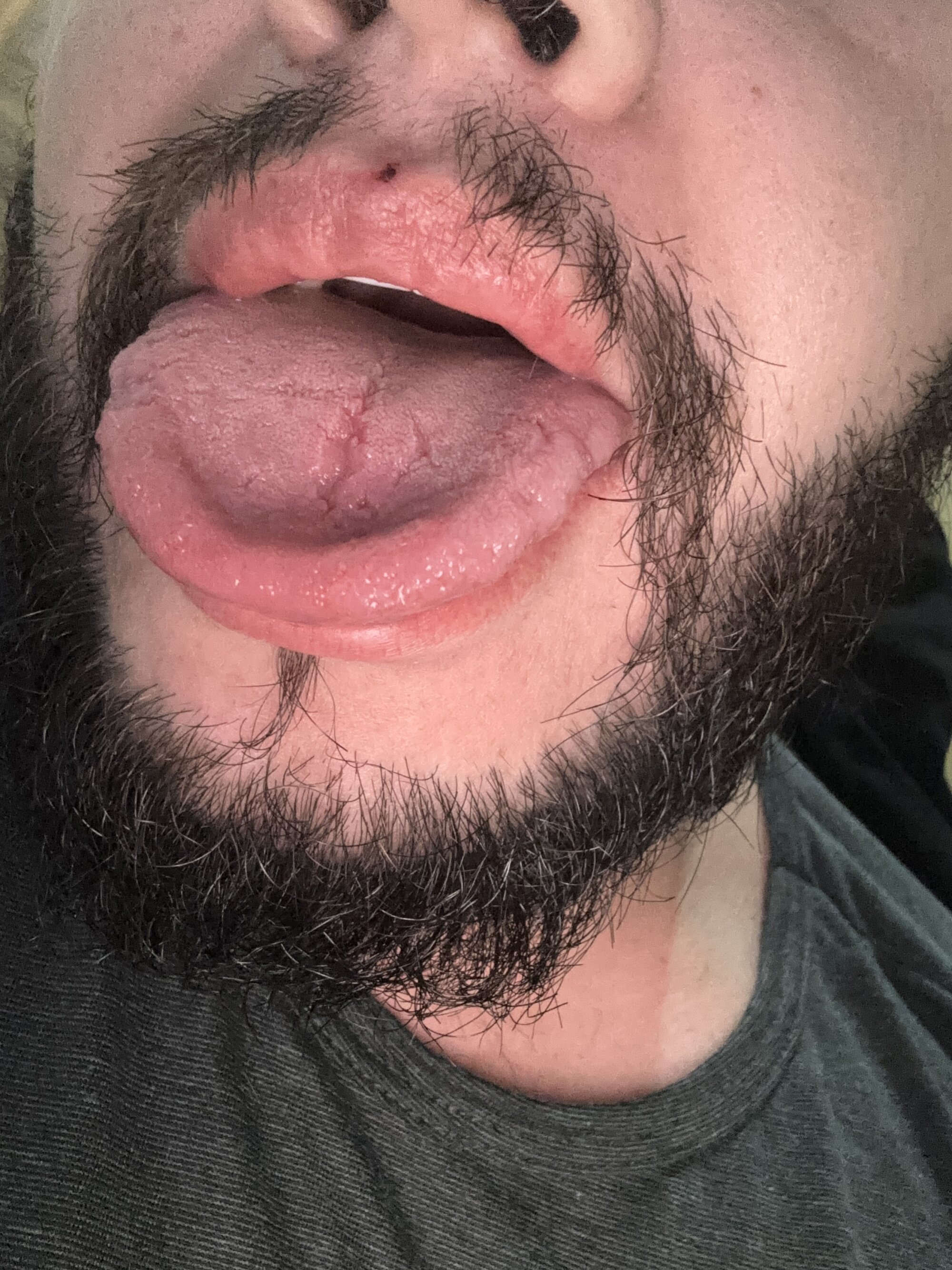 gauchopv