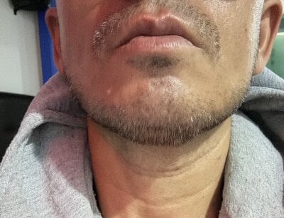 Pitogrande_82