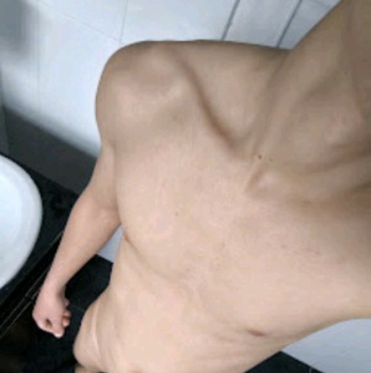 Flaco17CMVenoso