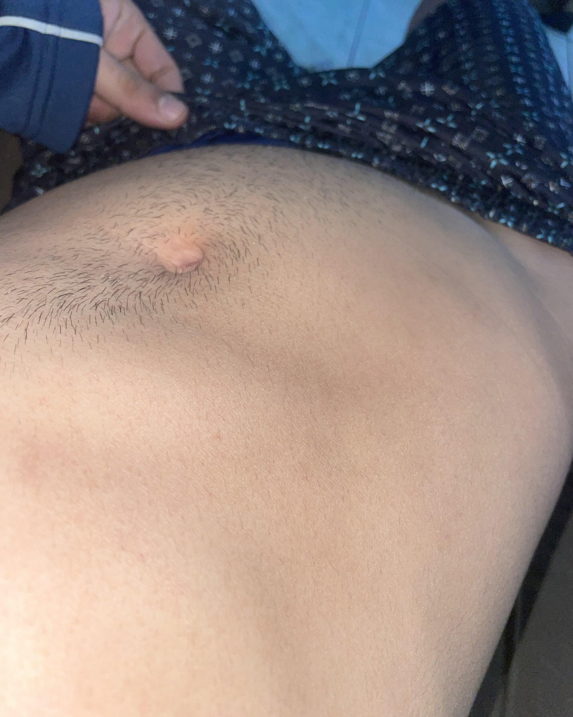 Oie635