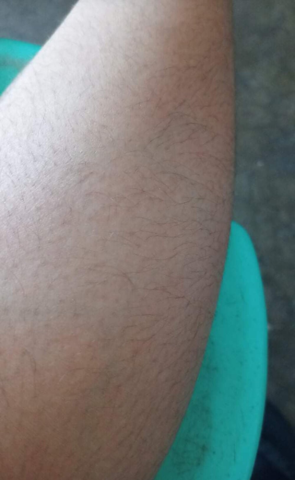 skinnyteeen