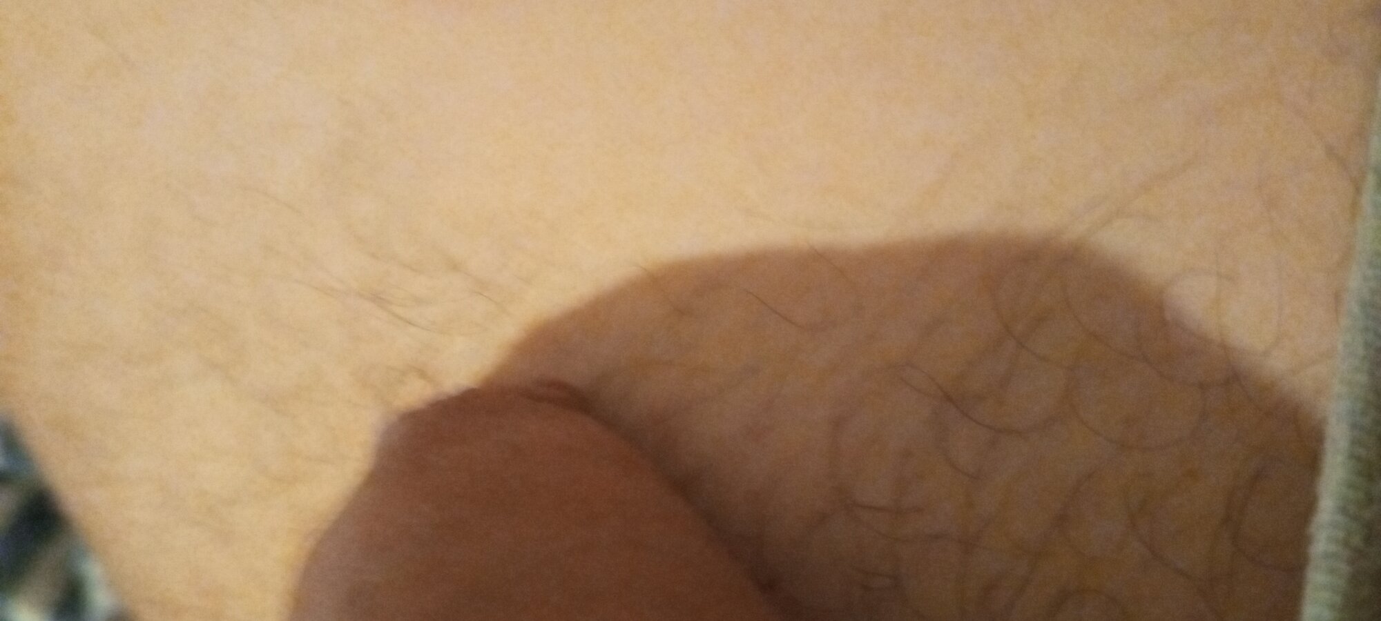 xolvo