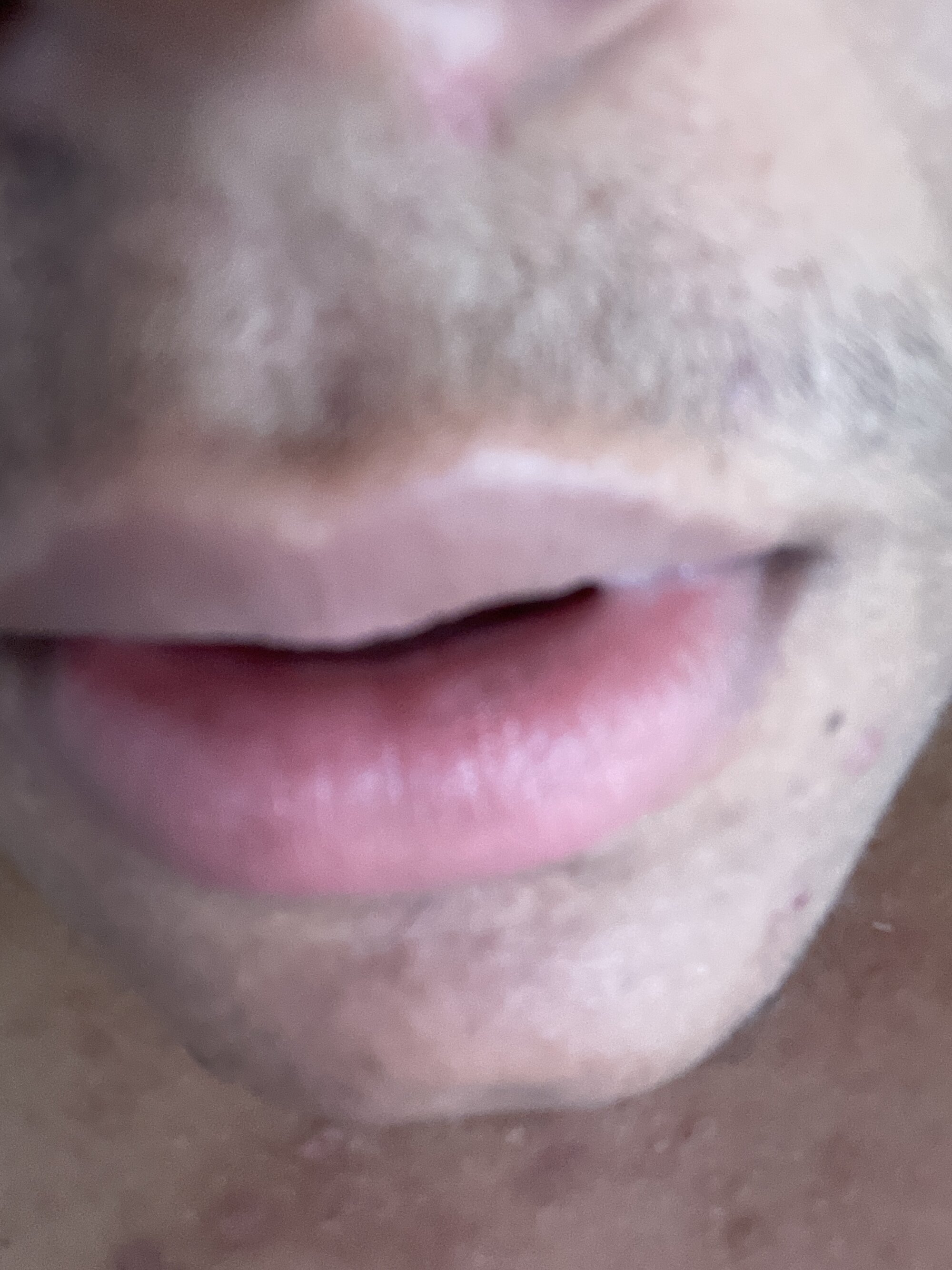 gordinhostrip
