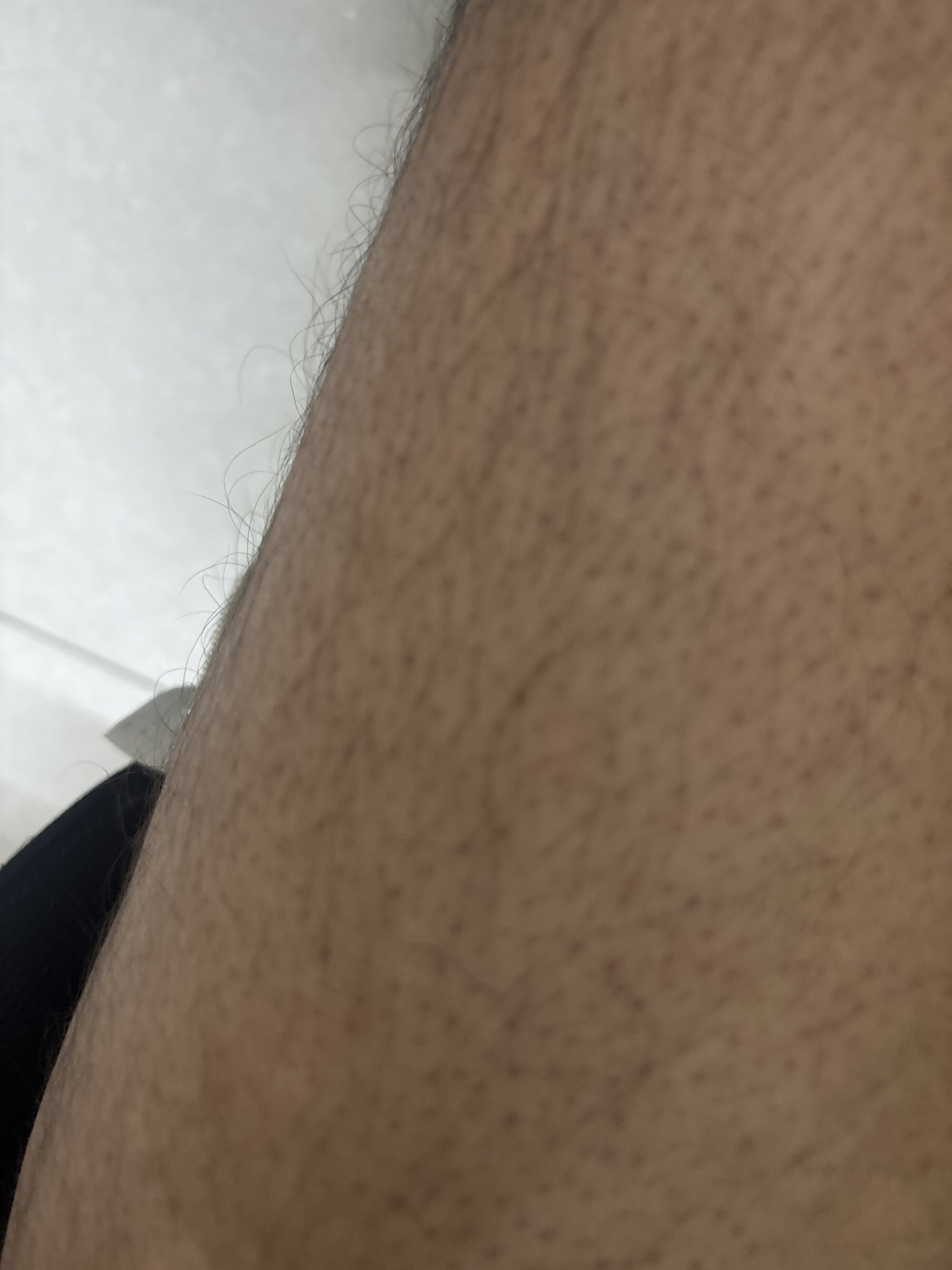 bulligadu1