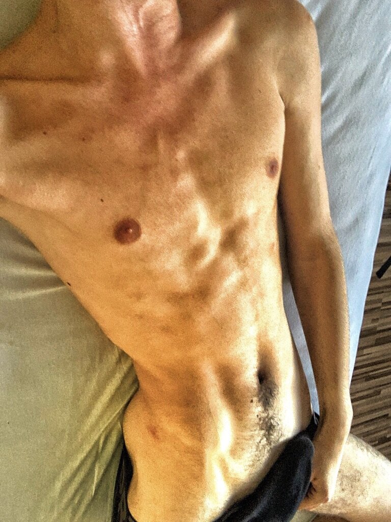 skinnytwinkxxx