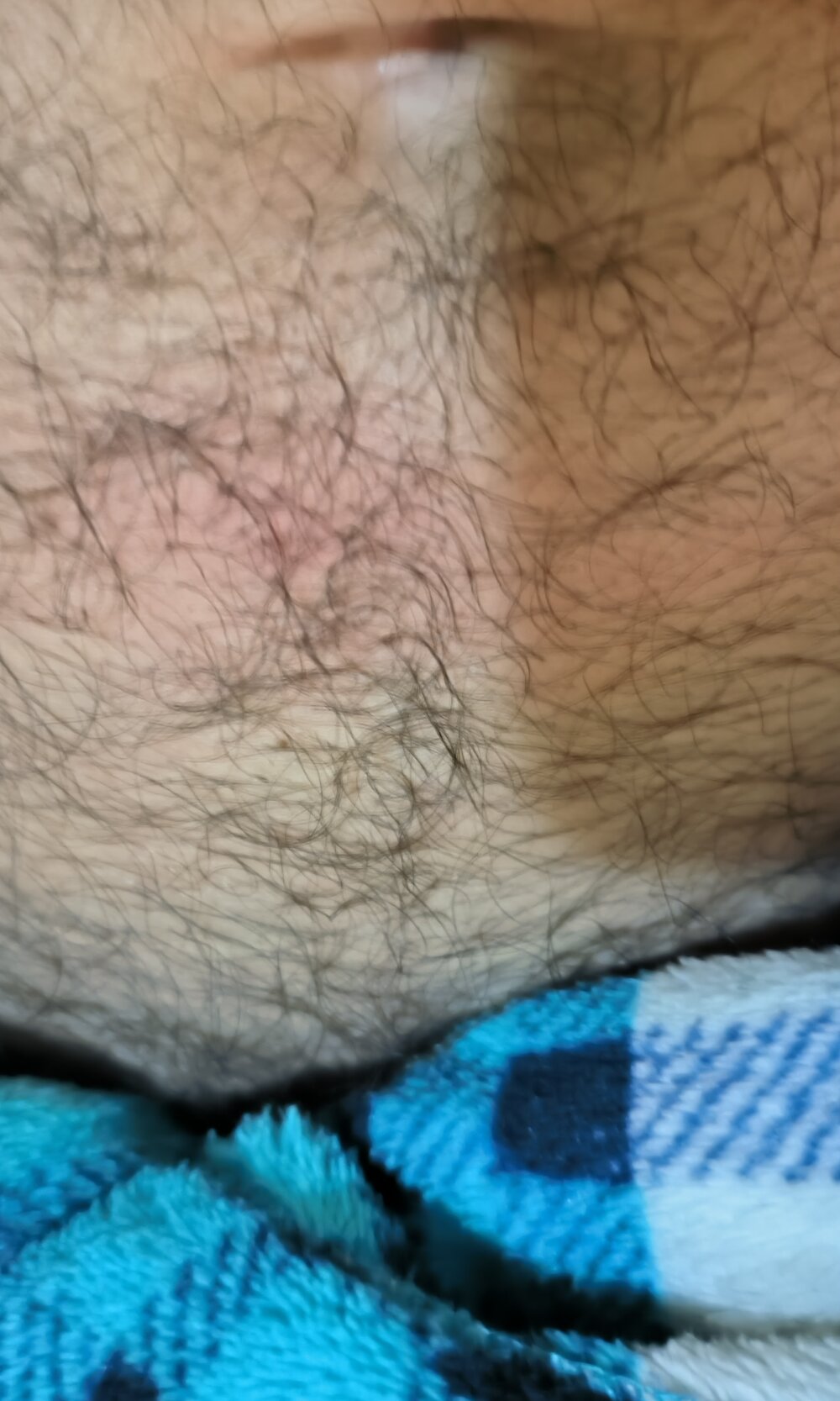 Platanocongofio's most recent online preview