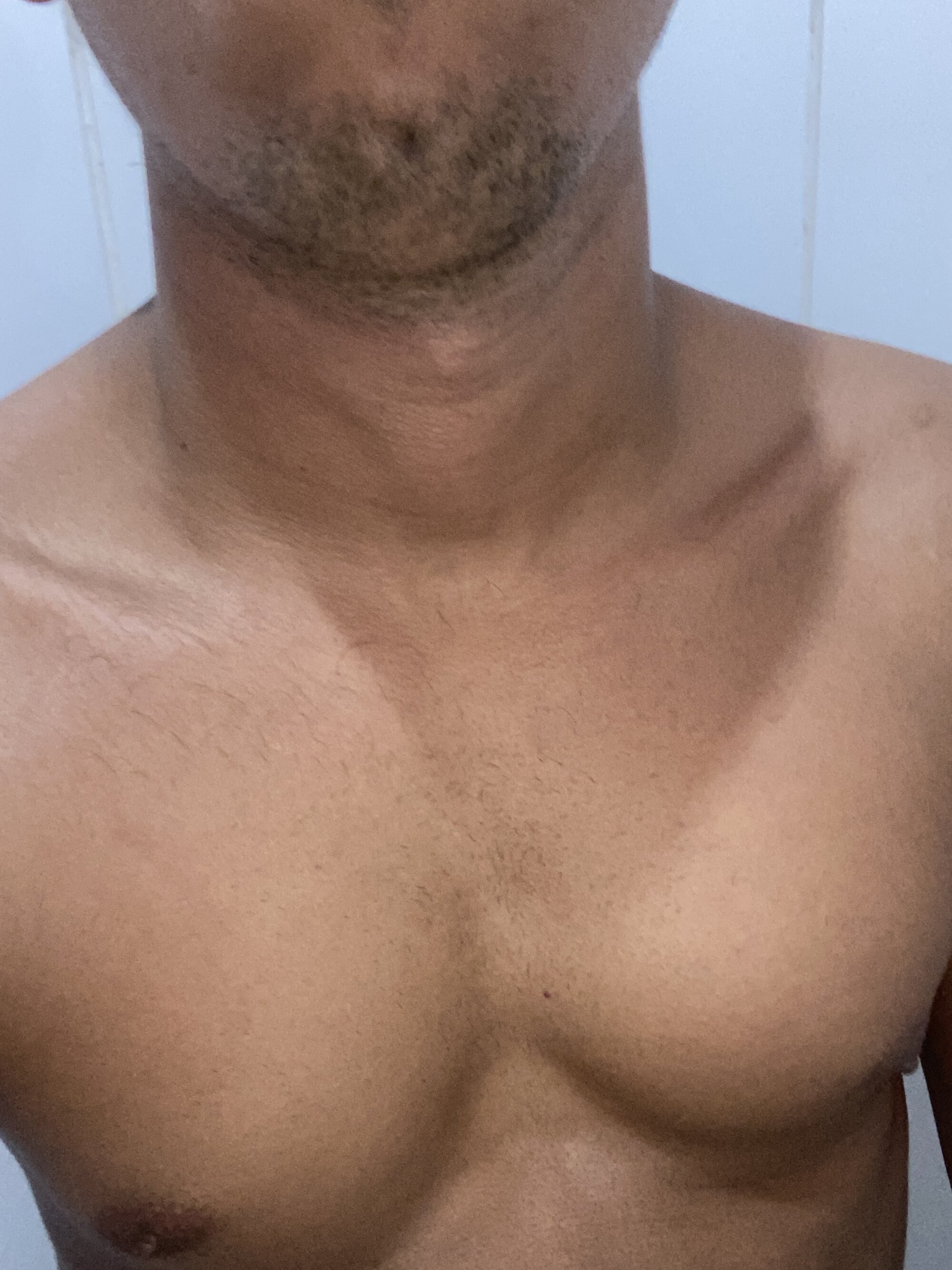 Pretin88