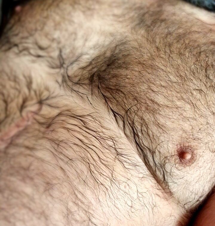 EnolicDenture