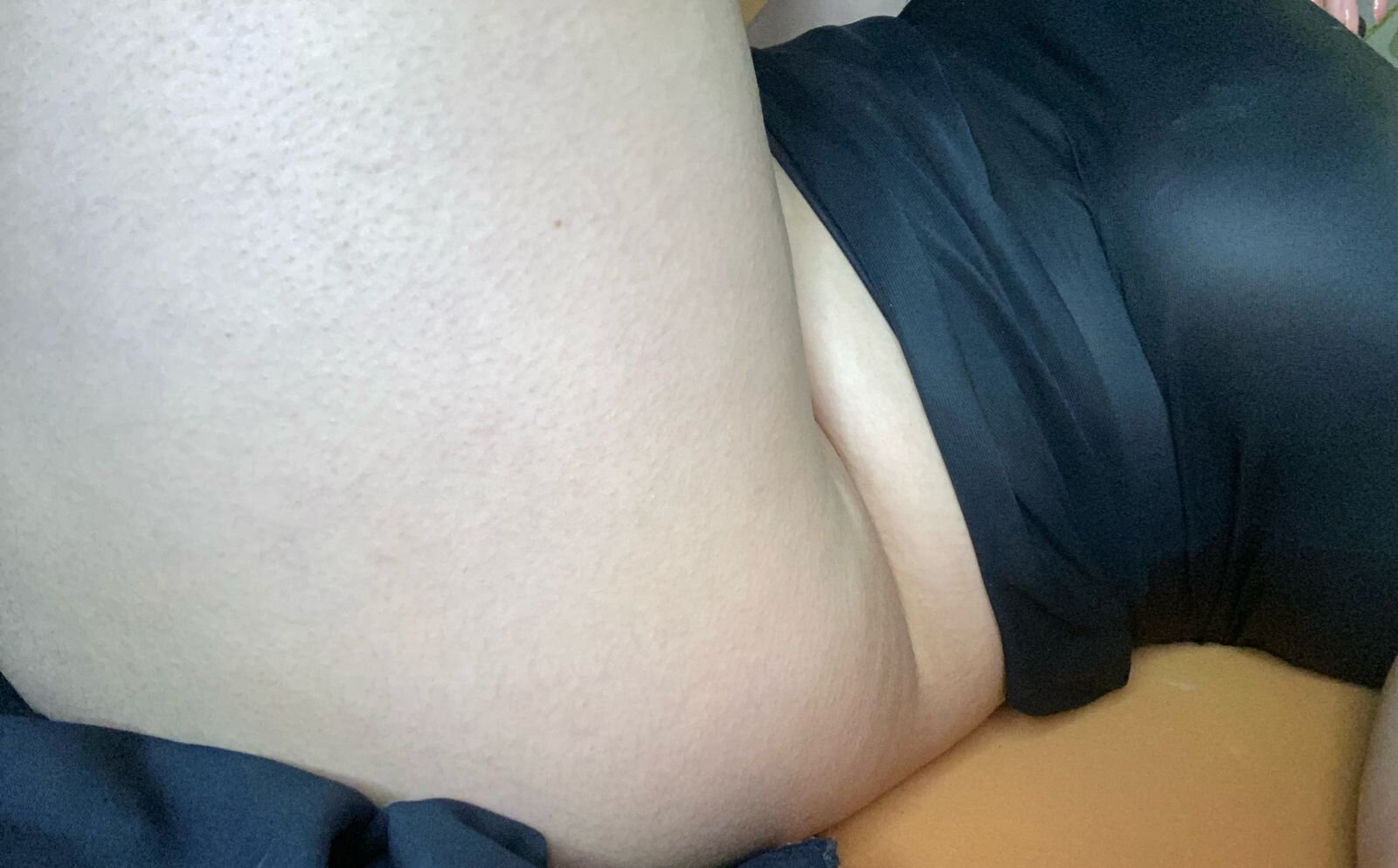 Sweet_cervix