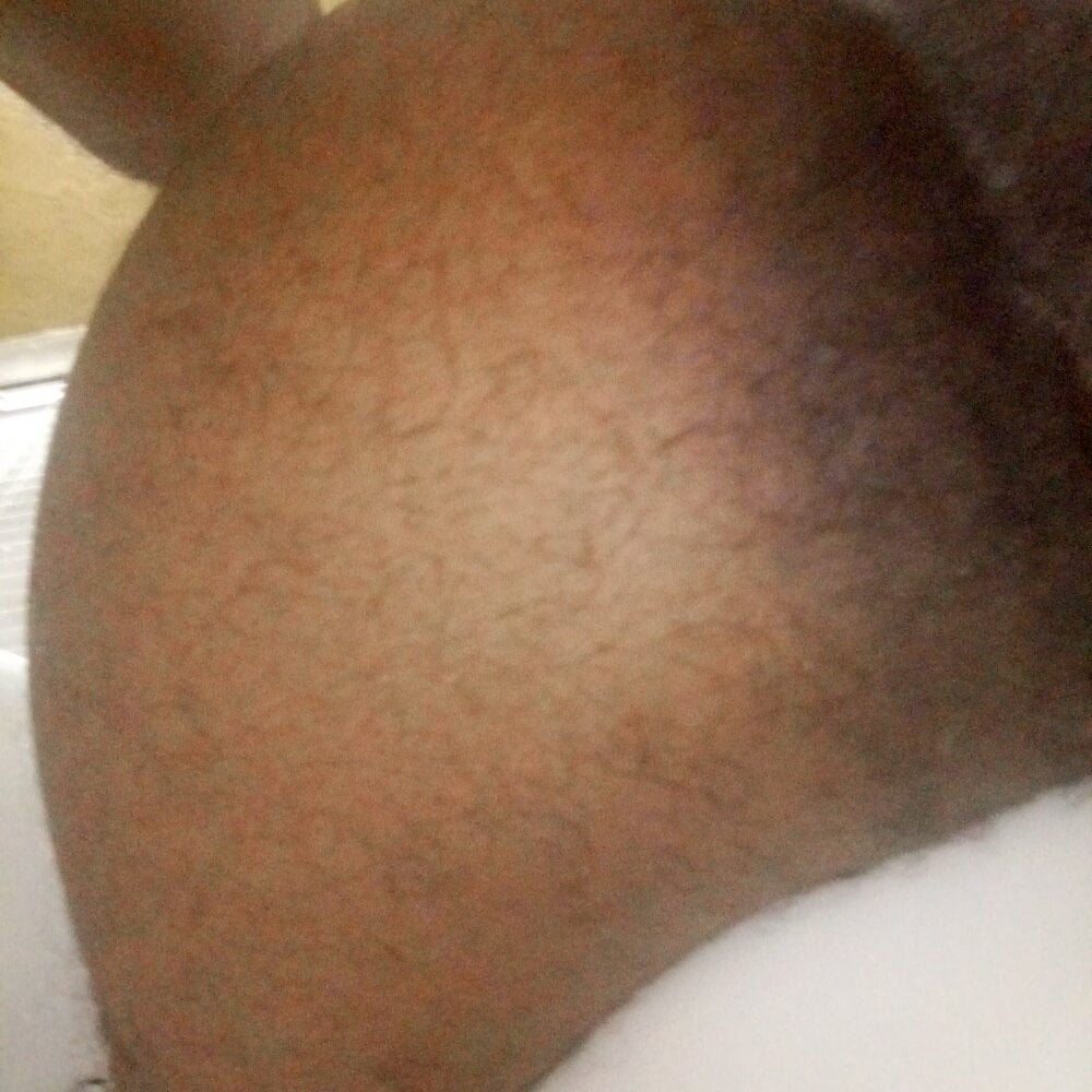ASSNDDICK1 profile