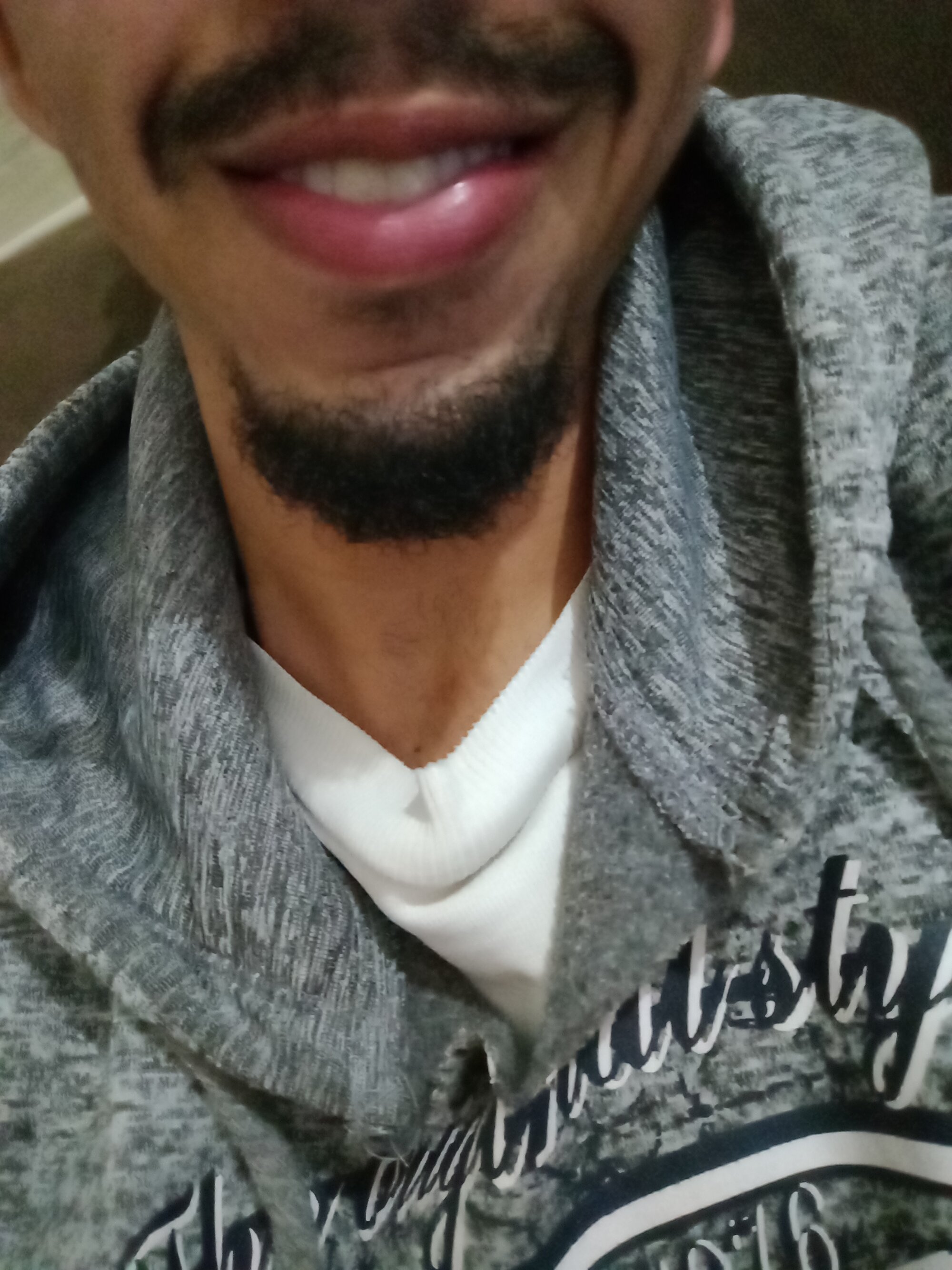 MagrinPentelho1