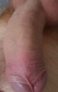 malegrossebite offline chatrum