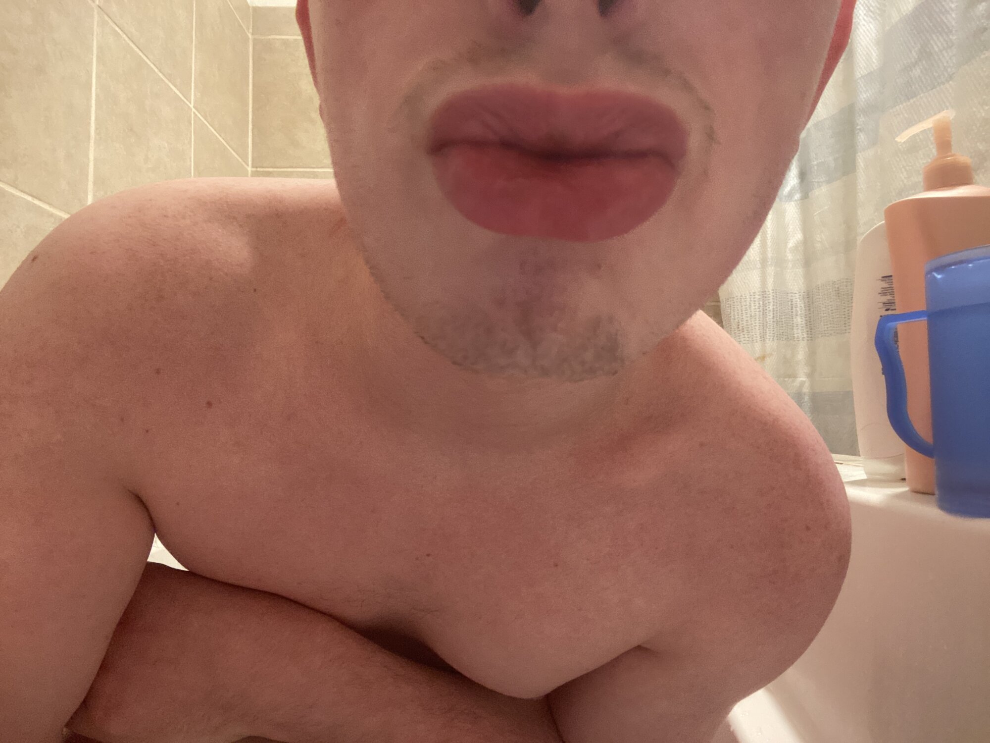 TyDog5