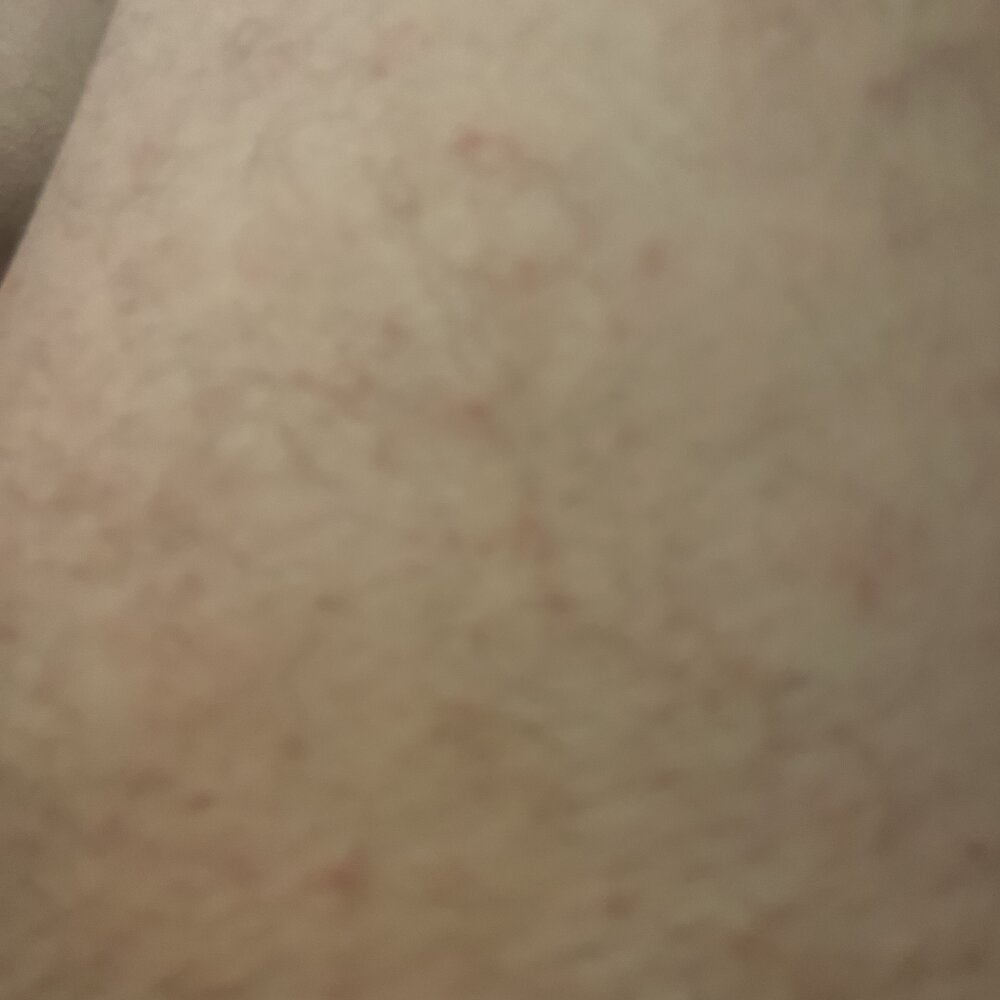 babi_SLP profile