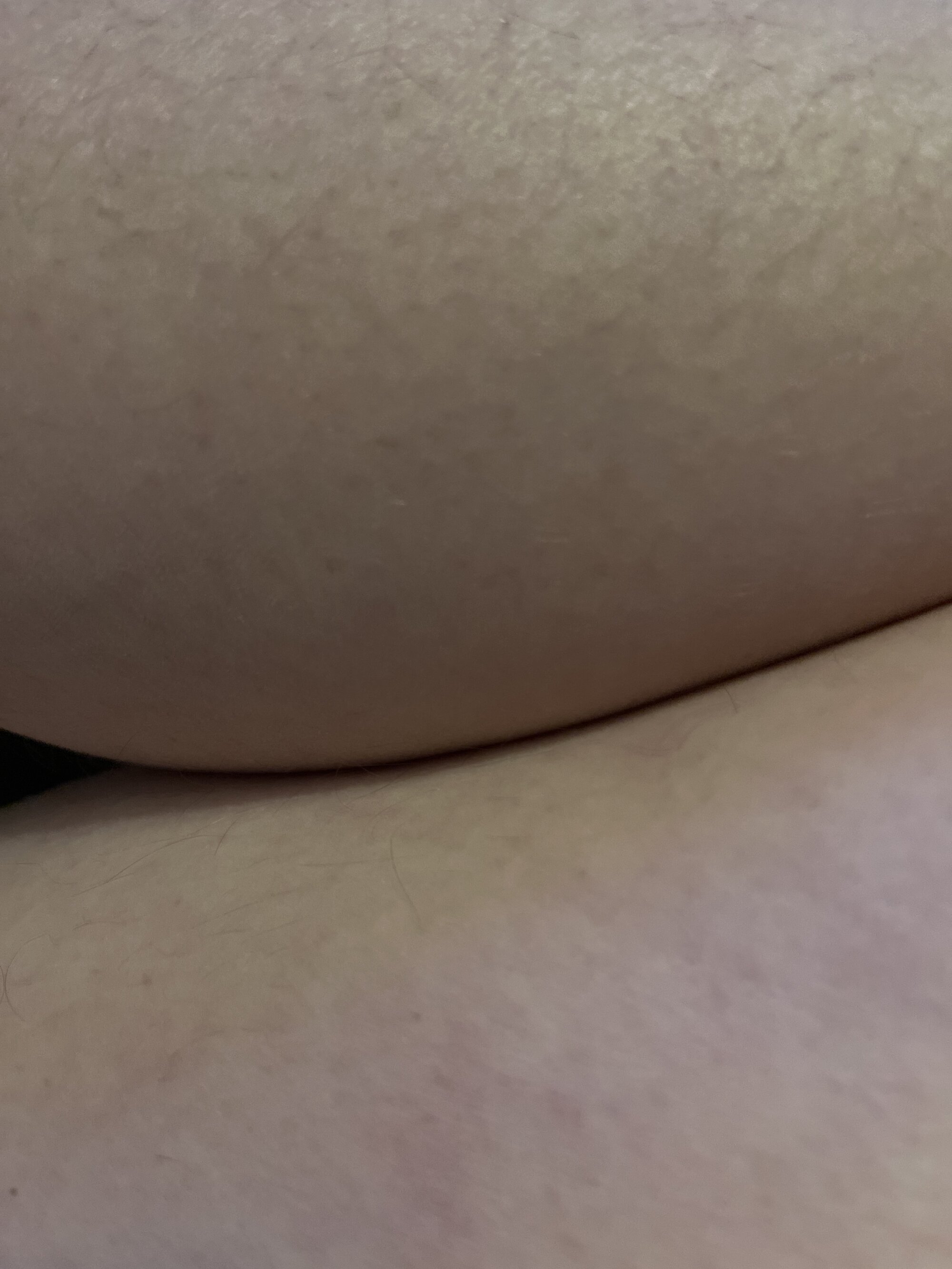 Xbi_bottom