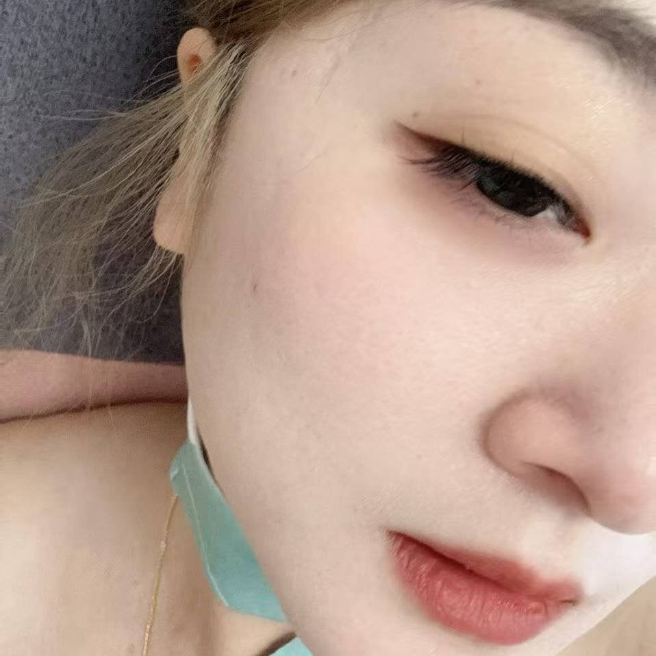 Aloe-p profile