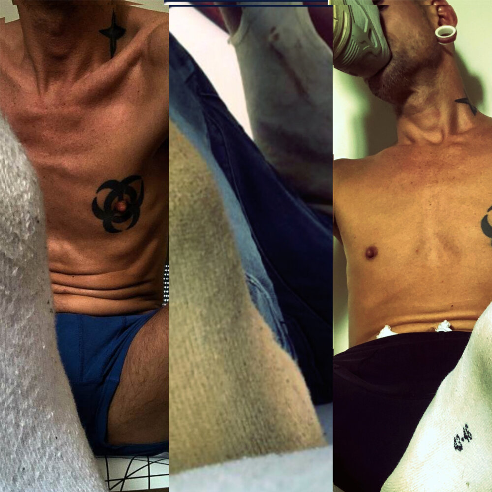 skinbare