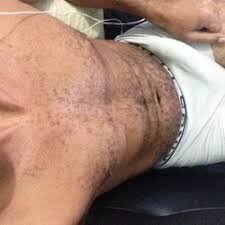XXX Porn Photo of Nude _not- 5