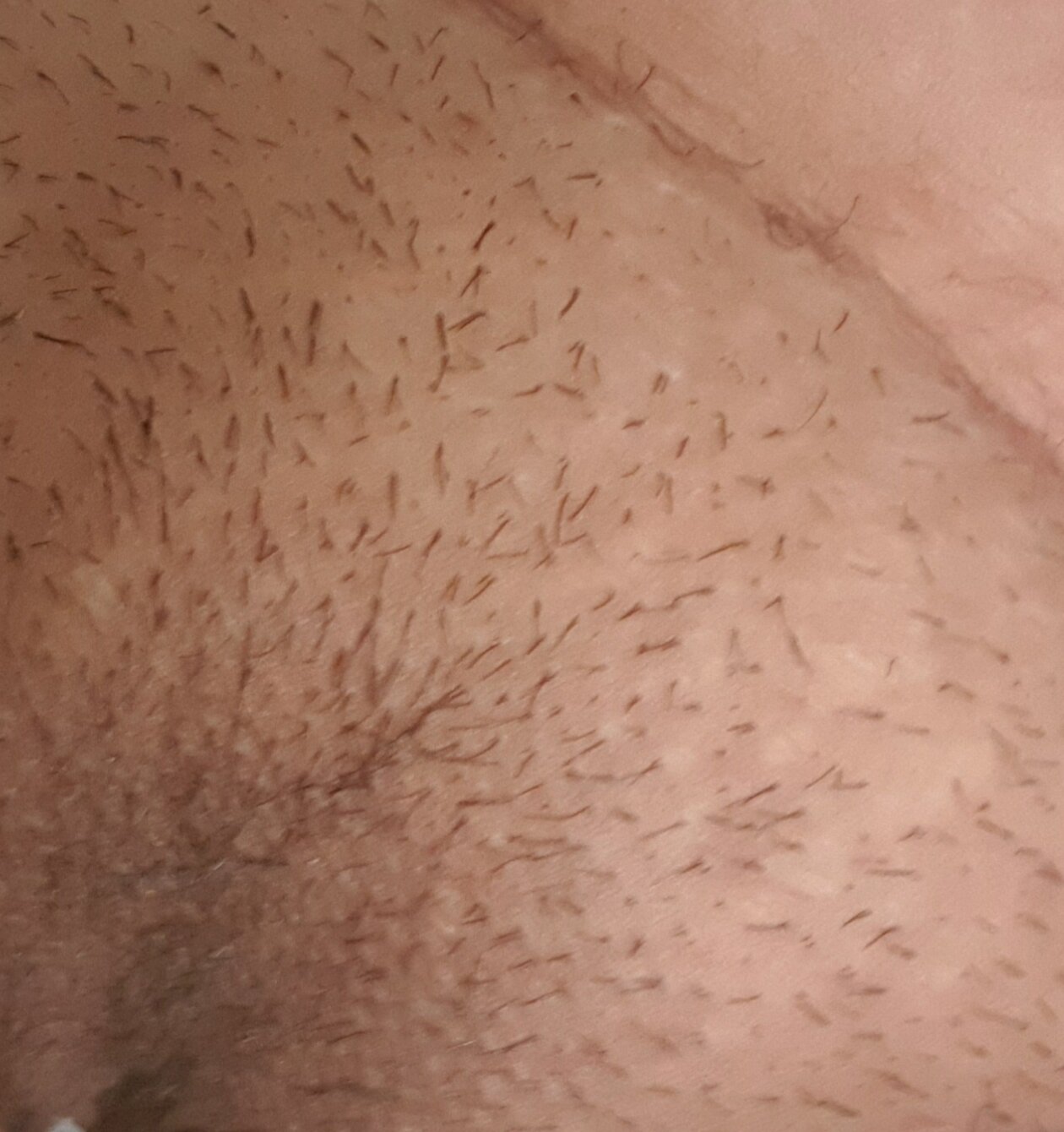 XXX Porn Photo of Nude parejaghxxx 5